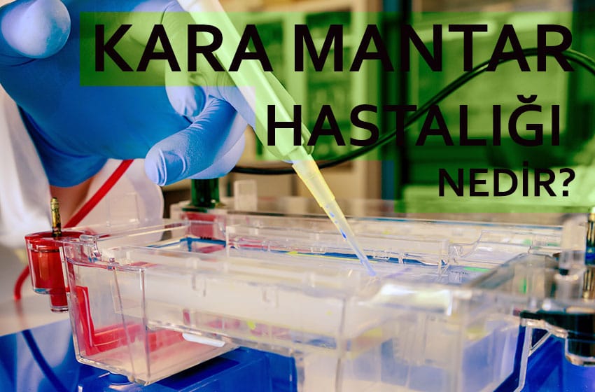 kara mantar hastalığı nedir